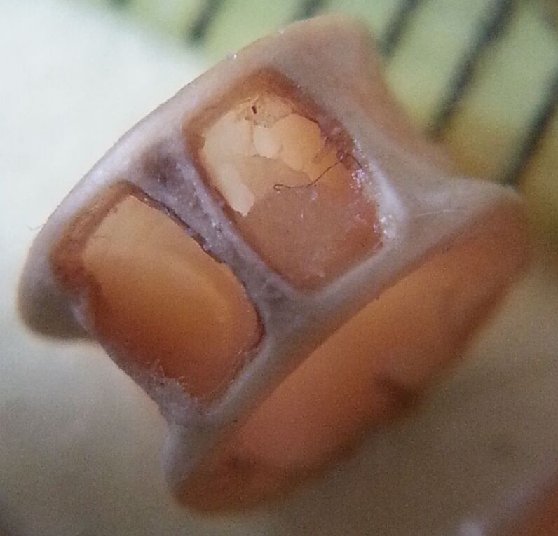 The Intricate Architecture of a Ray-Finned Fish Vertebra