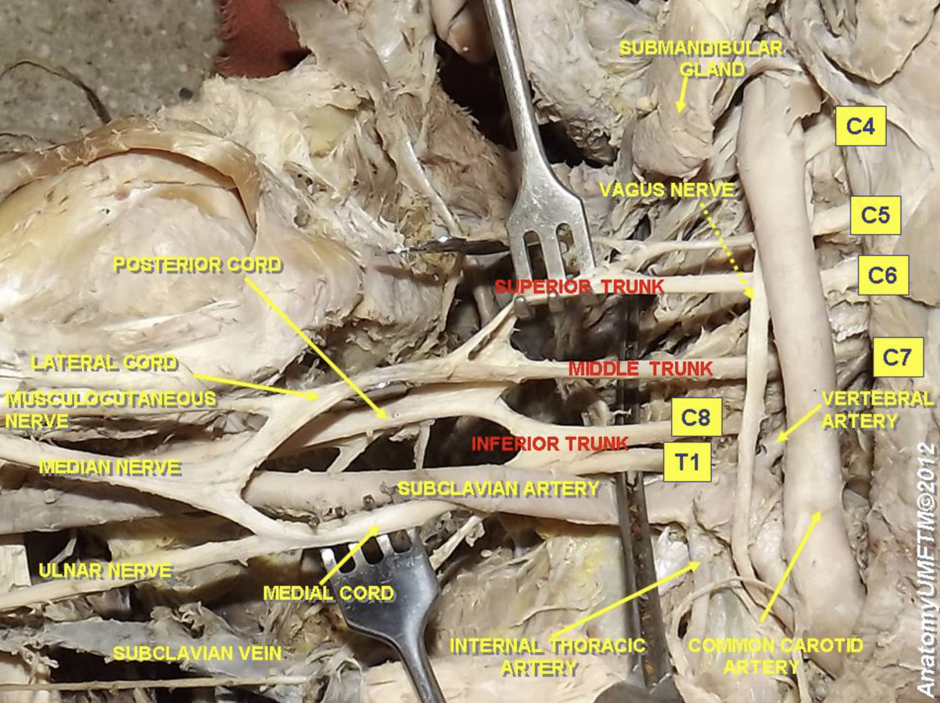 Functional Anatomy of the Brachial Plexus and Cervical Neurovasculature