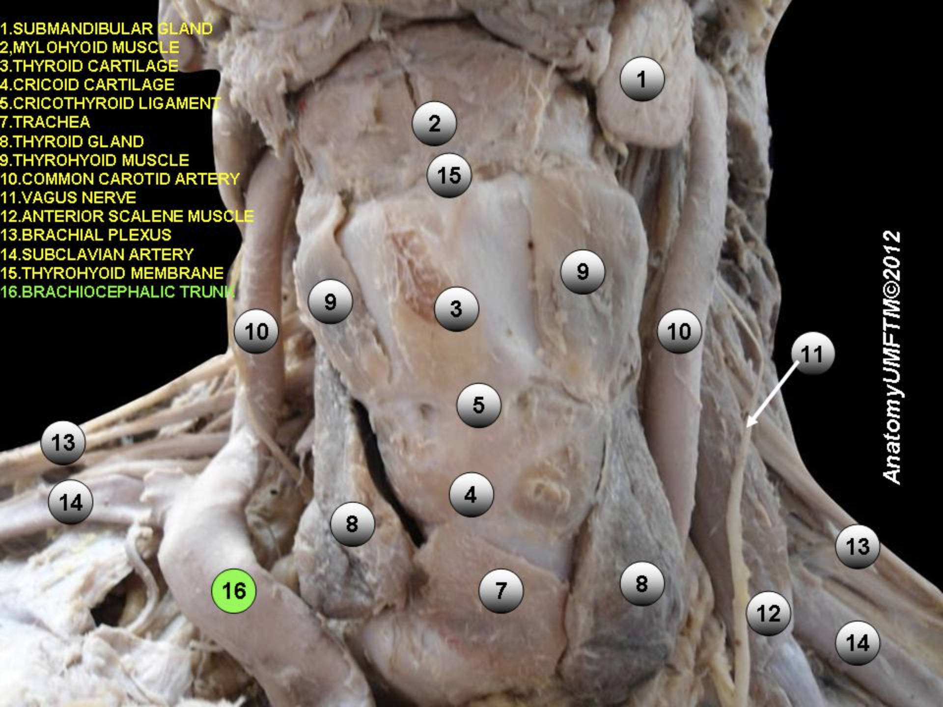 Detailed Anatomical Guide to the Brachiocephalic Artery and Neck Structures