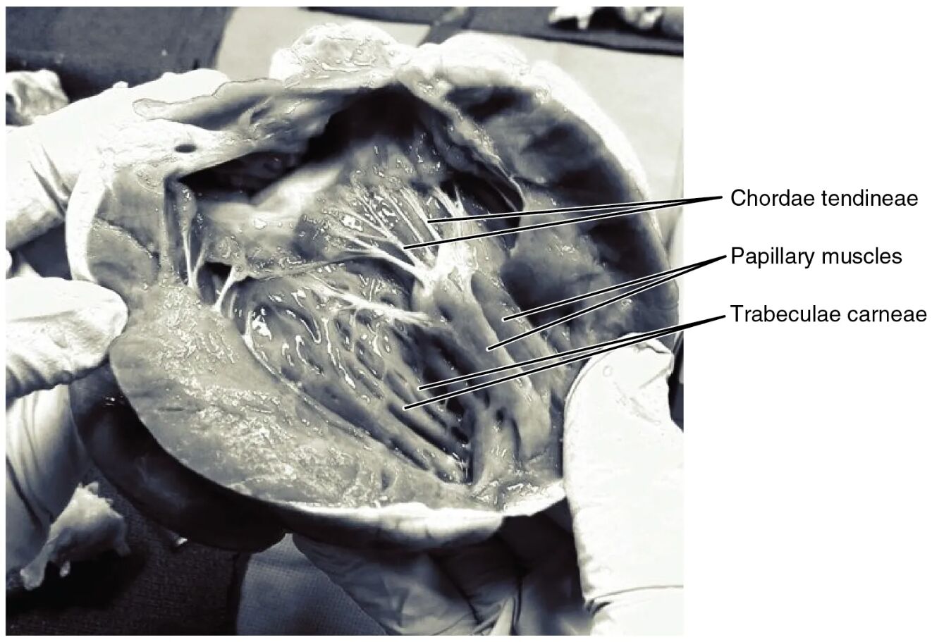 Chordae Tendineae and Papillary Muscles: Heart Anatomy Unveiled