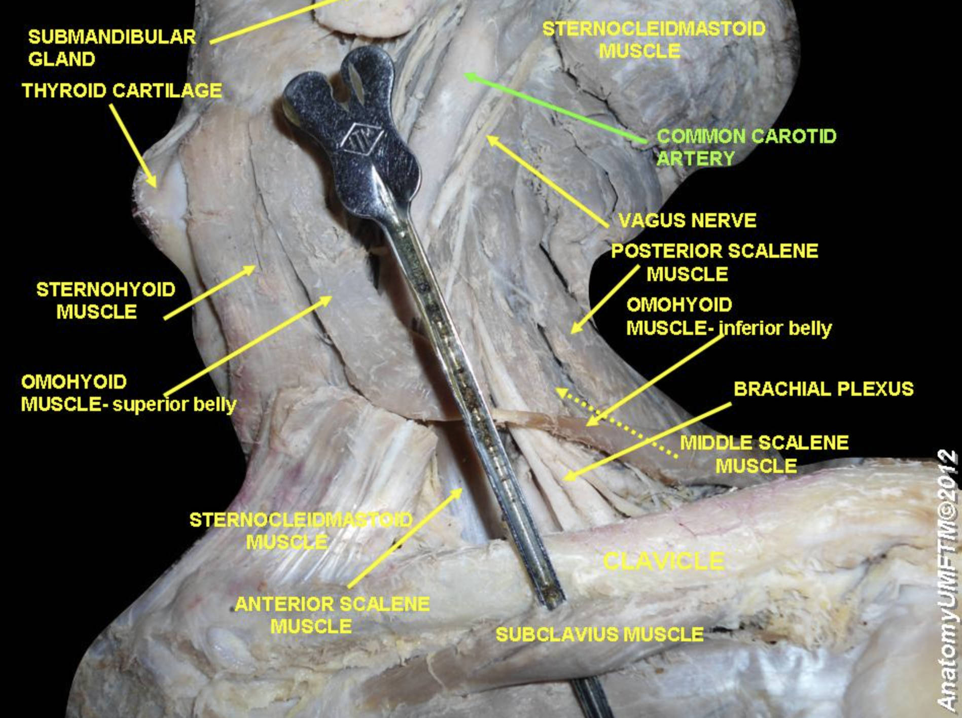 Comprehensive Anatomical Guide to the Common Carotid Artery and Cervical Neurovasculature