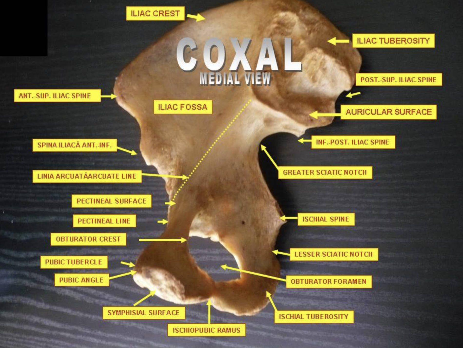 Anatomical Guide to the Medial View of the Hip Bone (Coxal Bone)