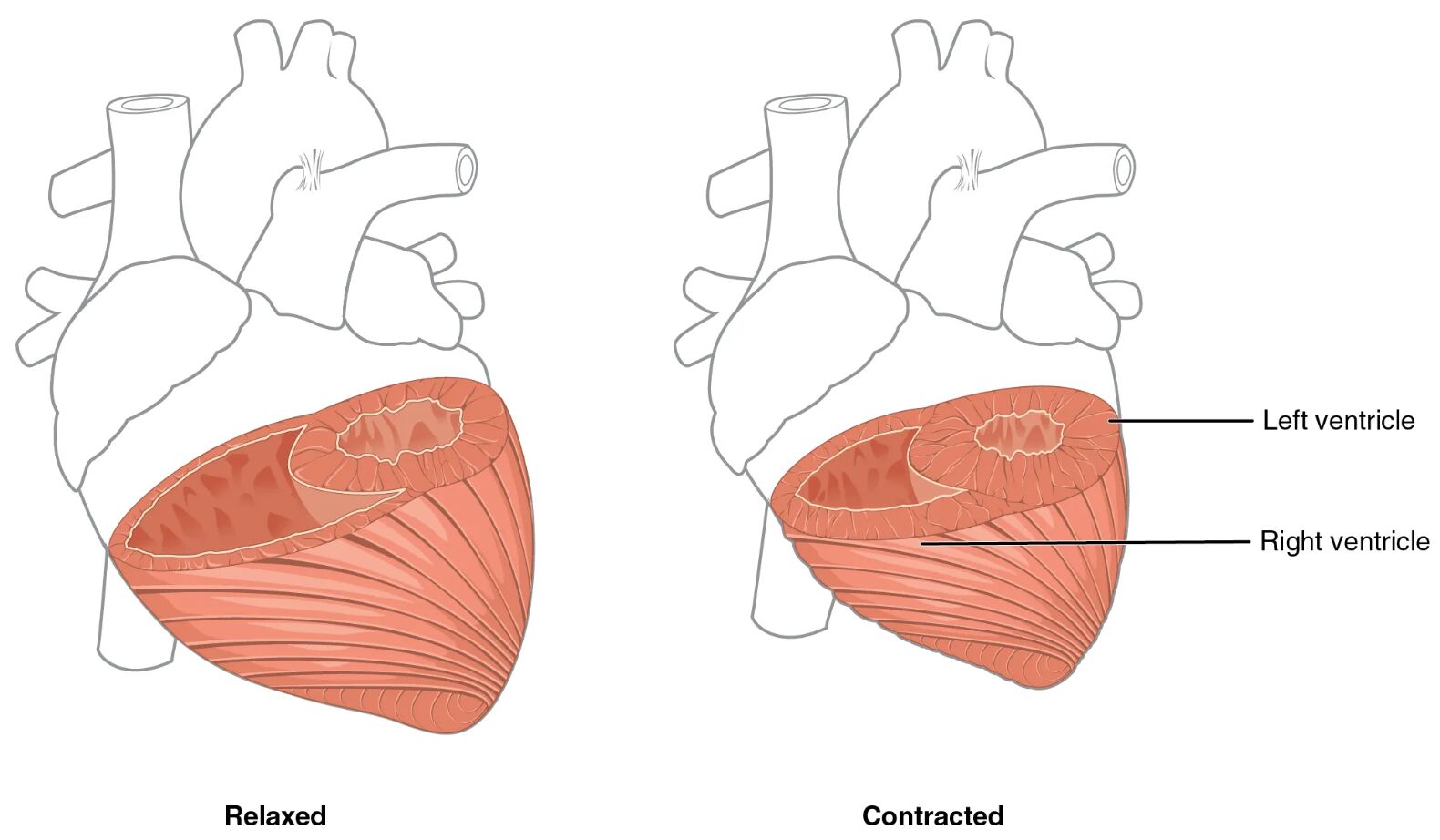 Differences in Ventricular Muscle Thickness Diagram: A Comparative Study