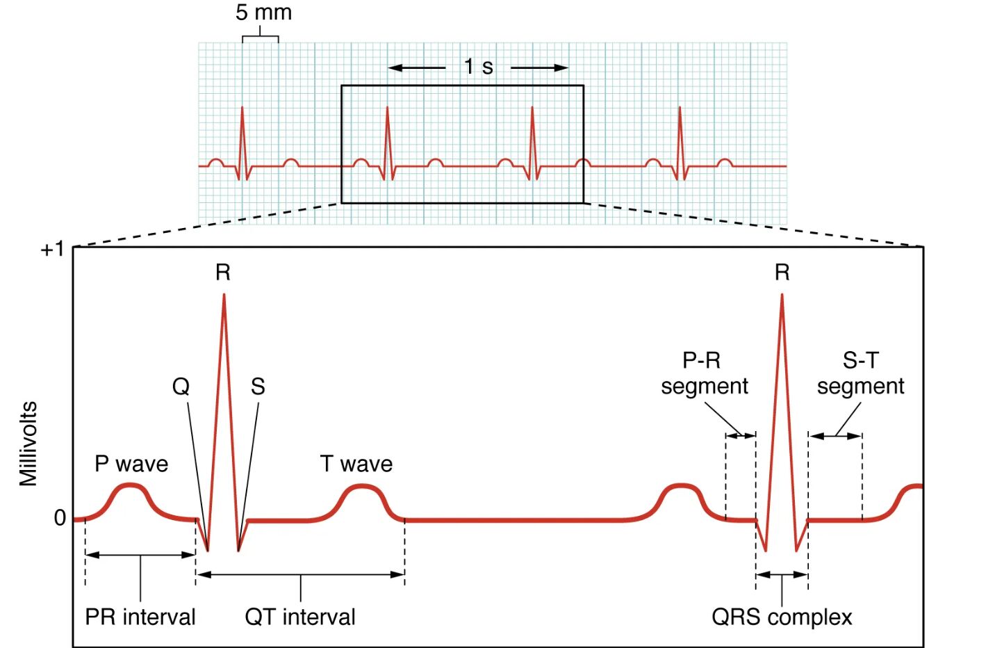 Electrocardiogram EKG Diagram: A Detailed Guide to Heart Activity