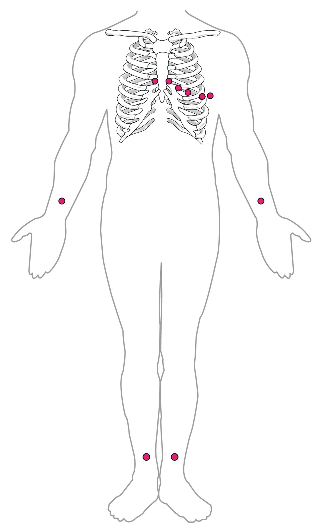 Standard Placement of ECG Leads Diagram: A Comprehensive Guide