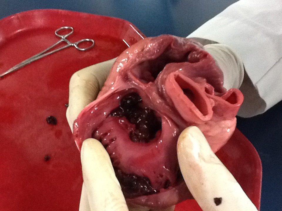 Hands-On Learning: Exploring Heart Anatomy Through Dissection