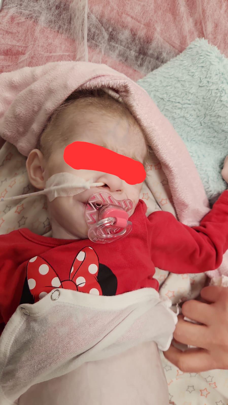 Adams-Oliver Syndrome (AOS)