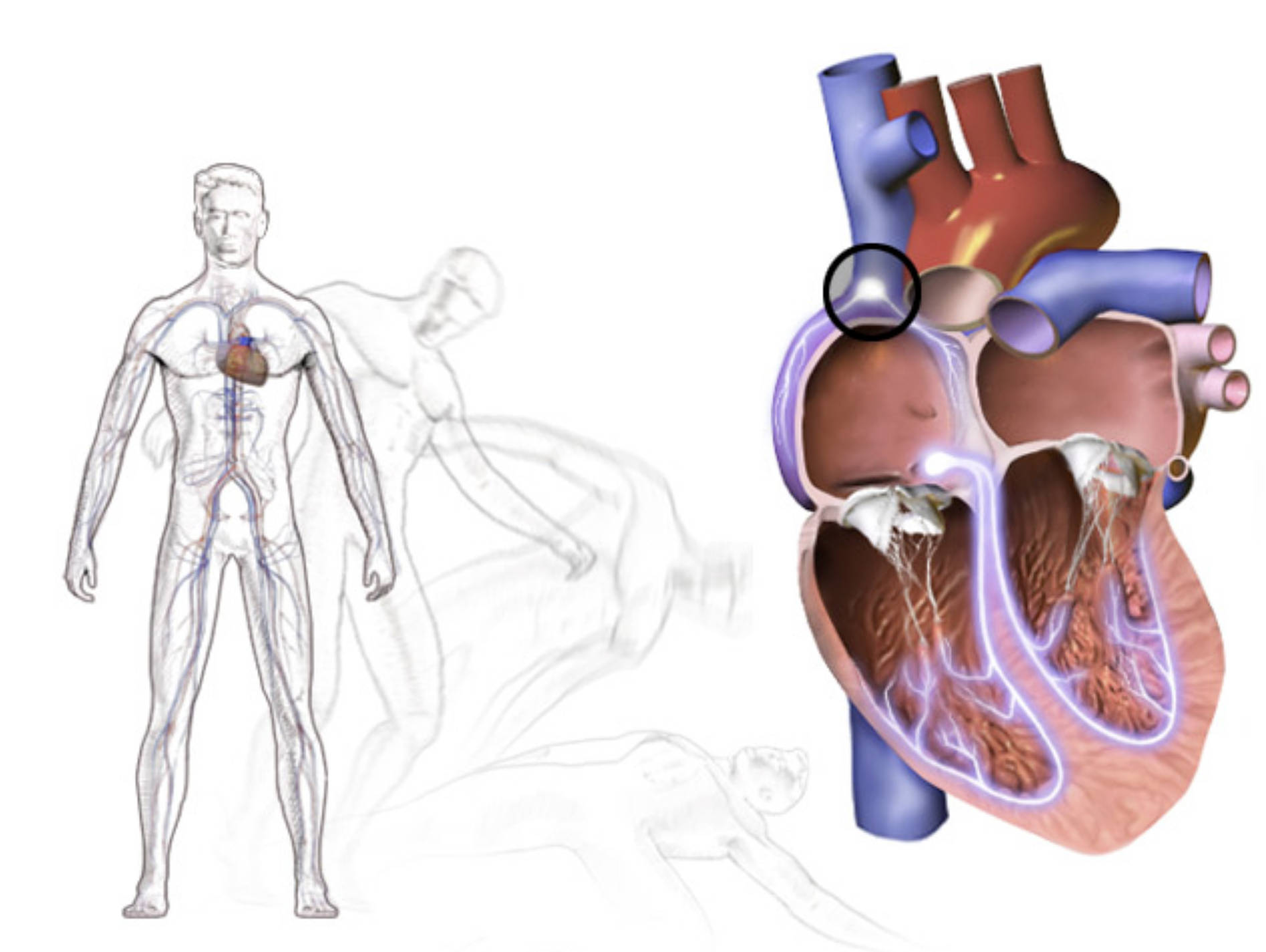 Understanding Bradycardia and Its Link to Fainting (Syncope)