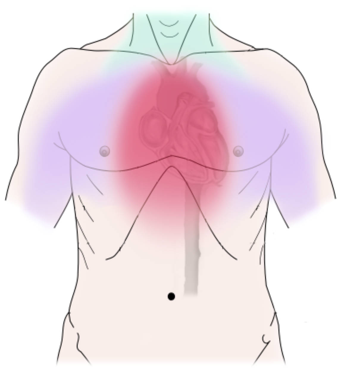 Understanding Discomfort: The Manifestations of Coronary Artery Disease
