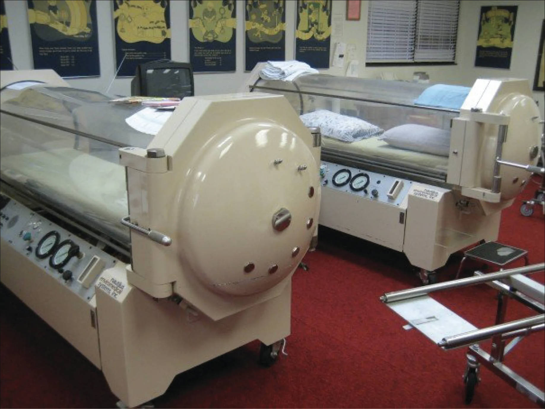 Hyperbaric Oxygen Therapy: An Overview of Hyperbaric Chambers