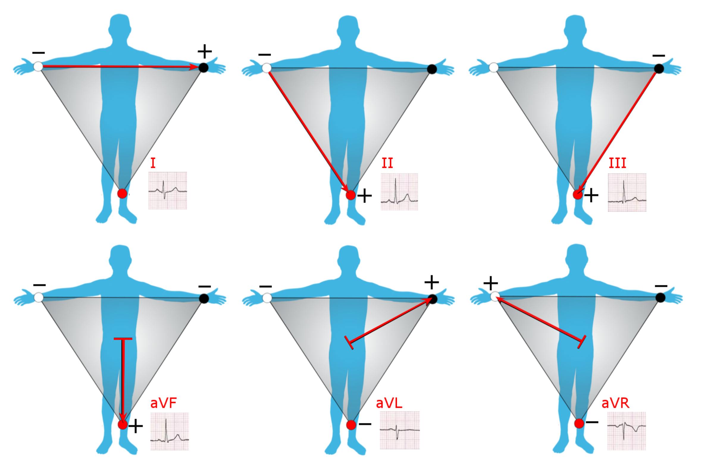 Understanding the Derivation of ECG Limb Leads: A Guide to Einthoven’s Triangle and Augmented Vectors