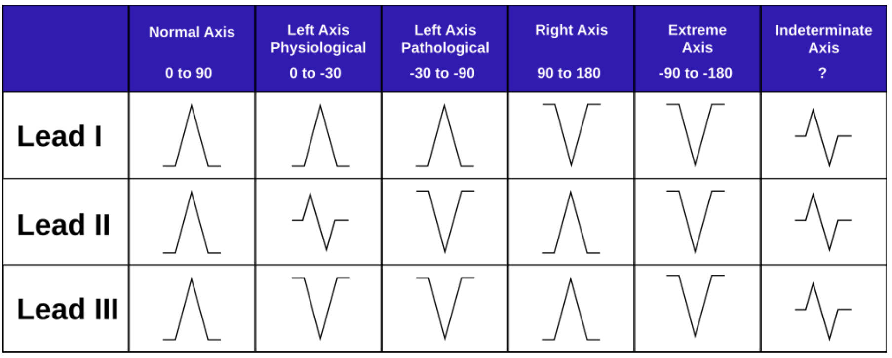 Mastering Cardiac Axis Deviation: A Guide to ECG Lead Interpretation