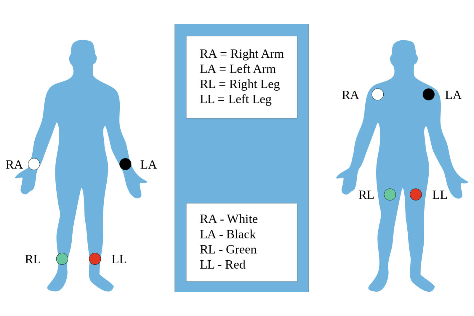 Mastering ECG Limb Leads: Standard Electrode Placement and Anatomy