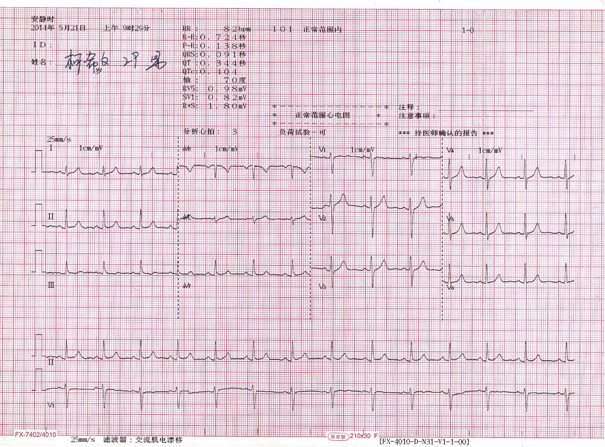 Comprehensive Guide to Interpreting a Normal 12-Lead Electrocardiogram (ECG)
