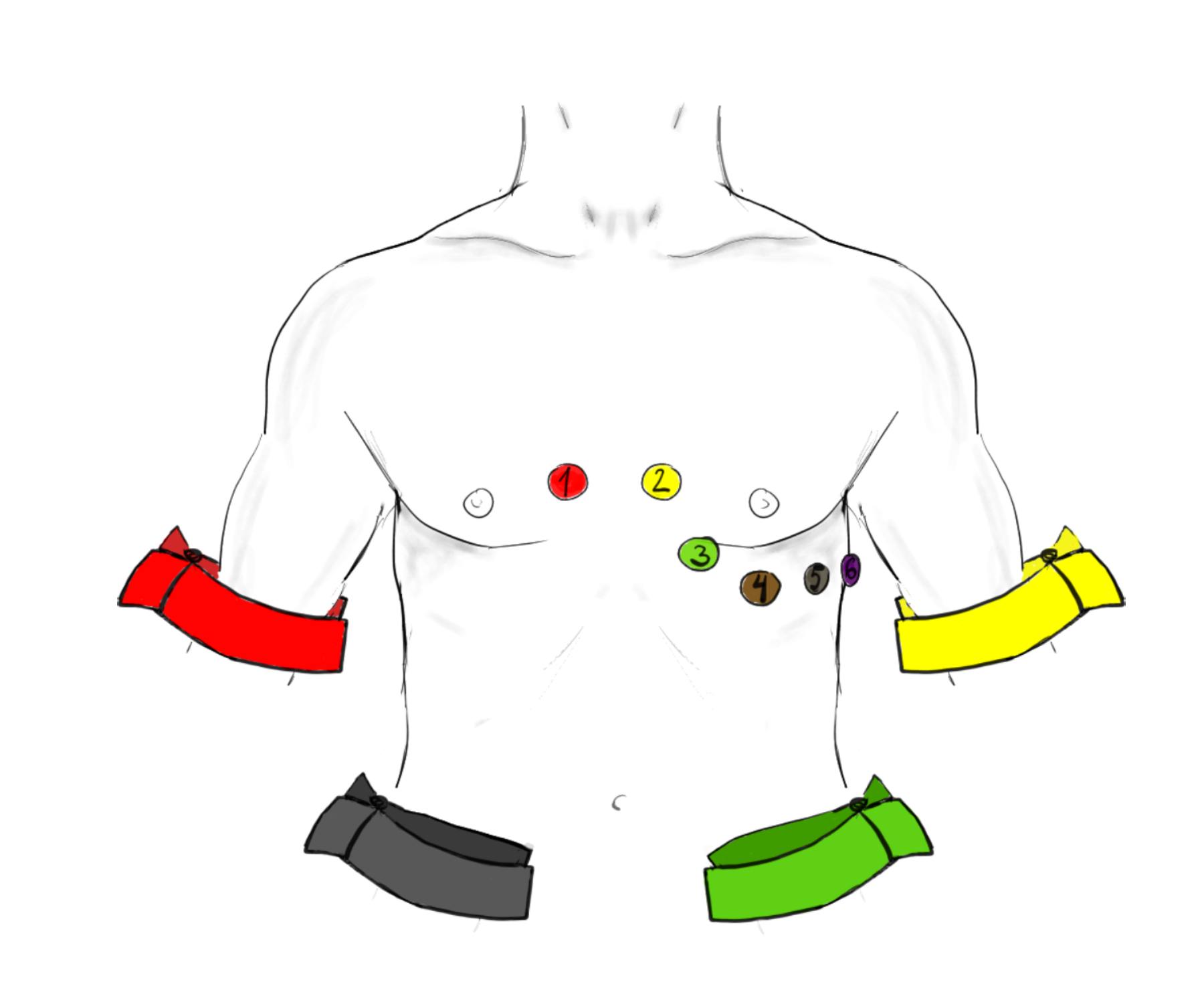 Comprehensive Guide to ECG Electrode Placement: Limb and Chest Leads