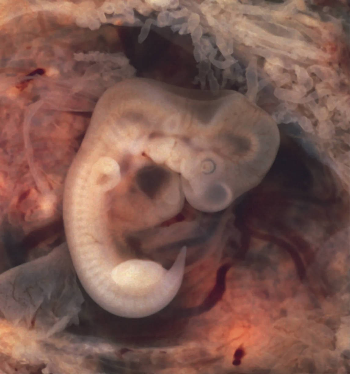 Embryo at 7 Weeks: A Glimpse into Early Human Development