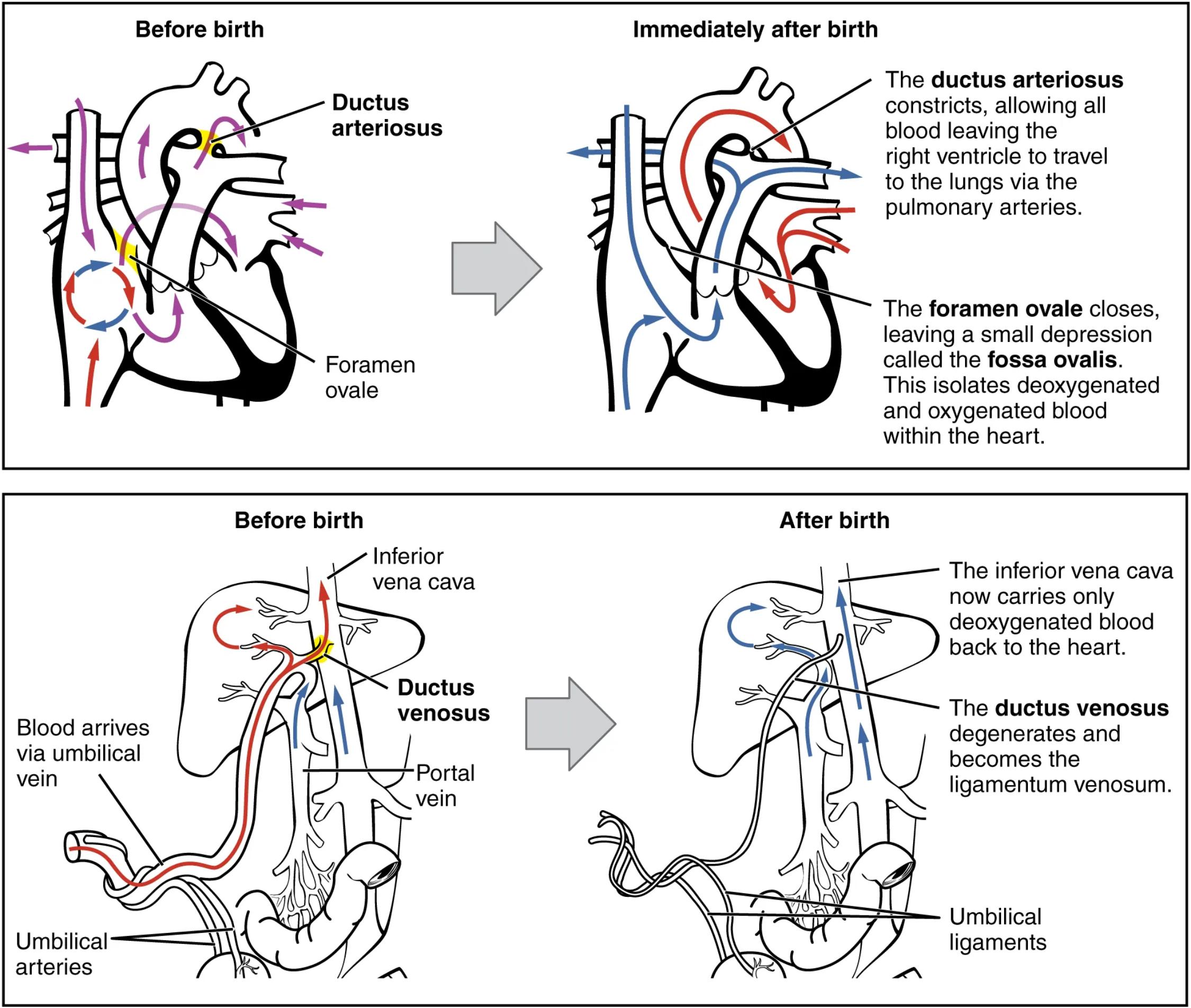 Neonatal Circulatory System: A Comprehensive Diagram