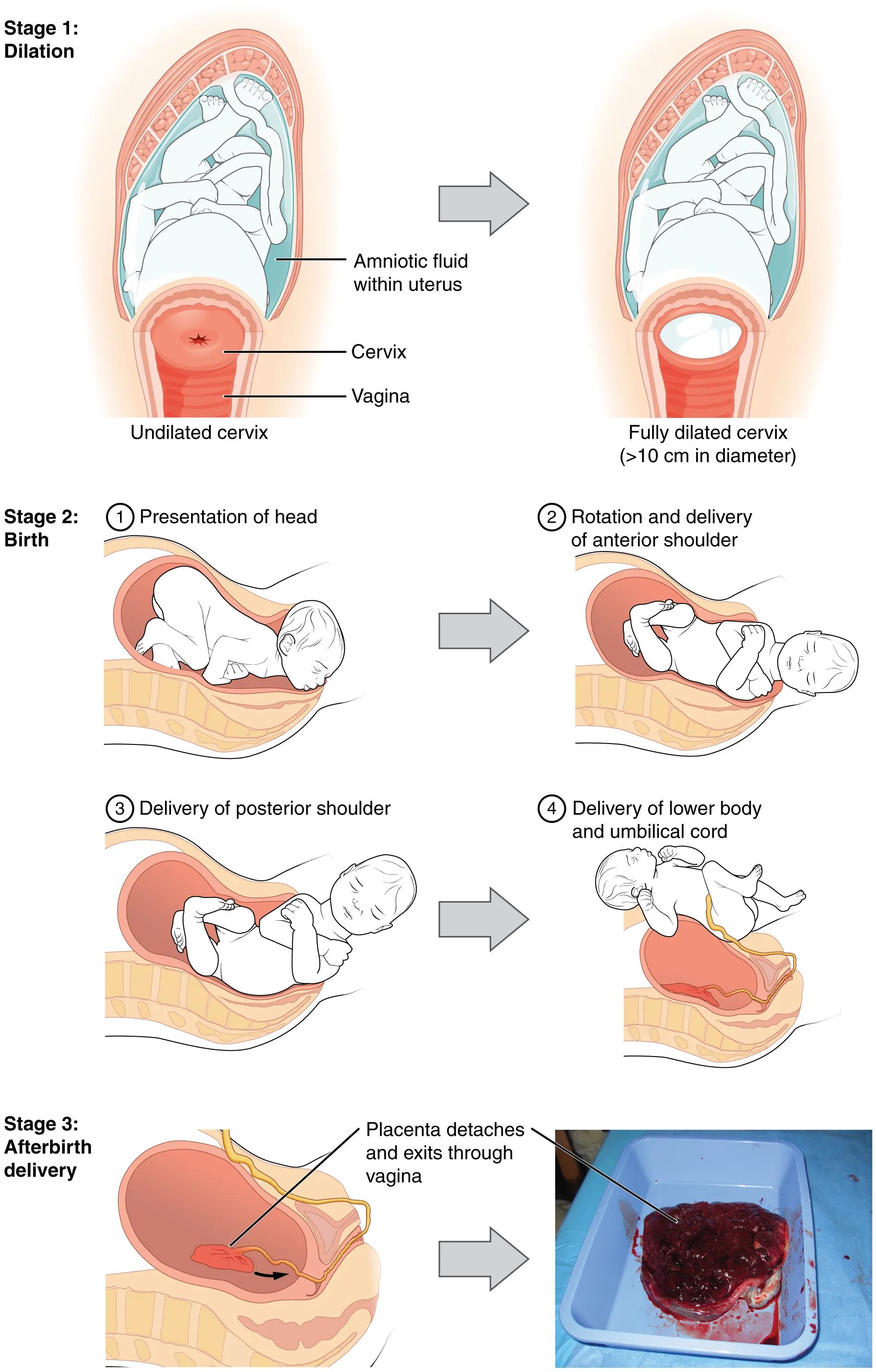 Stages of Childbirth: A Comprehensive Visual Guide to Labor and Delivery