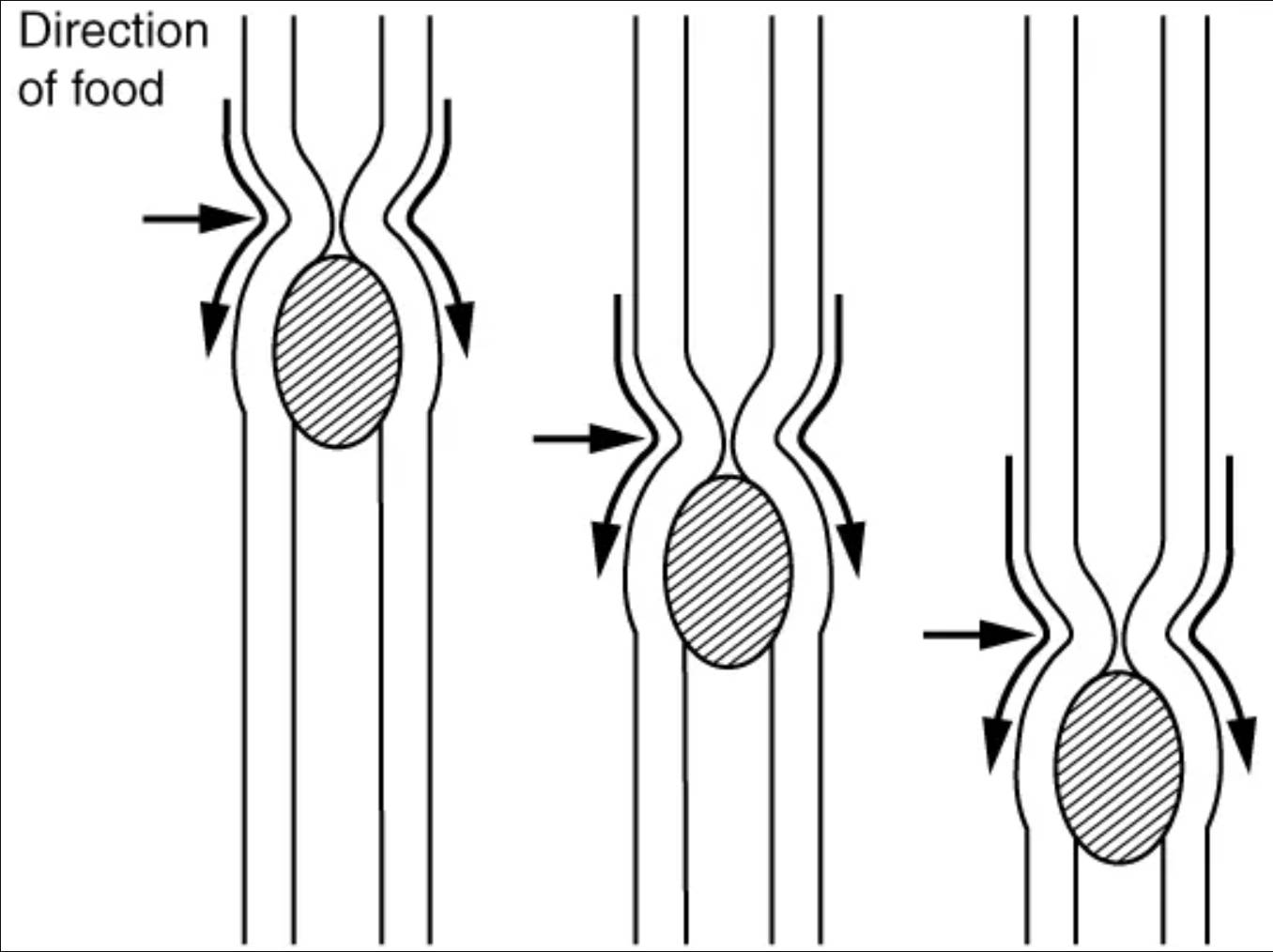 The Rhythmic Journey: Understanding Peristalsis in the Digestive Tract