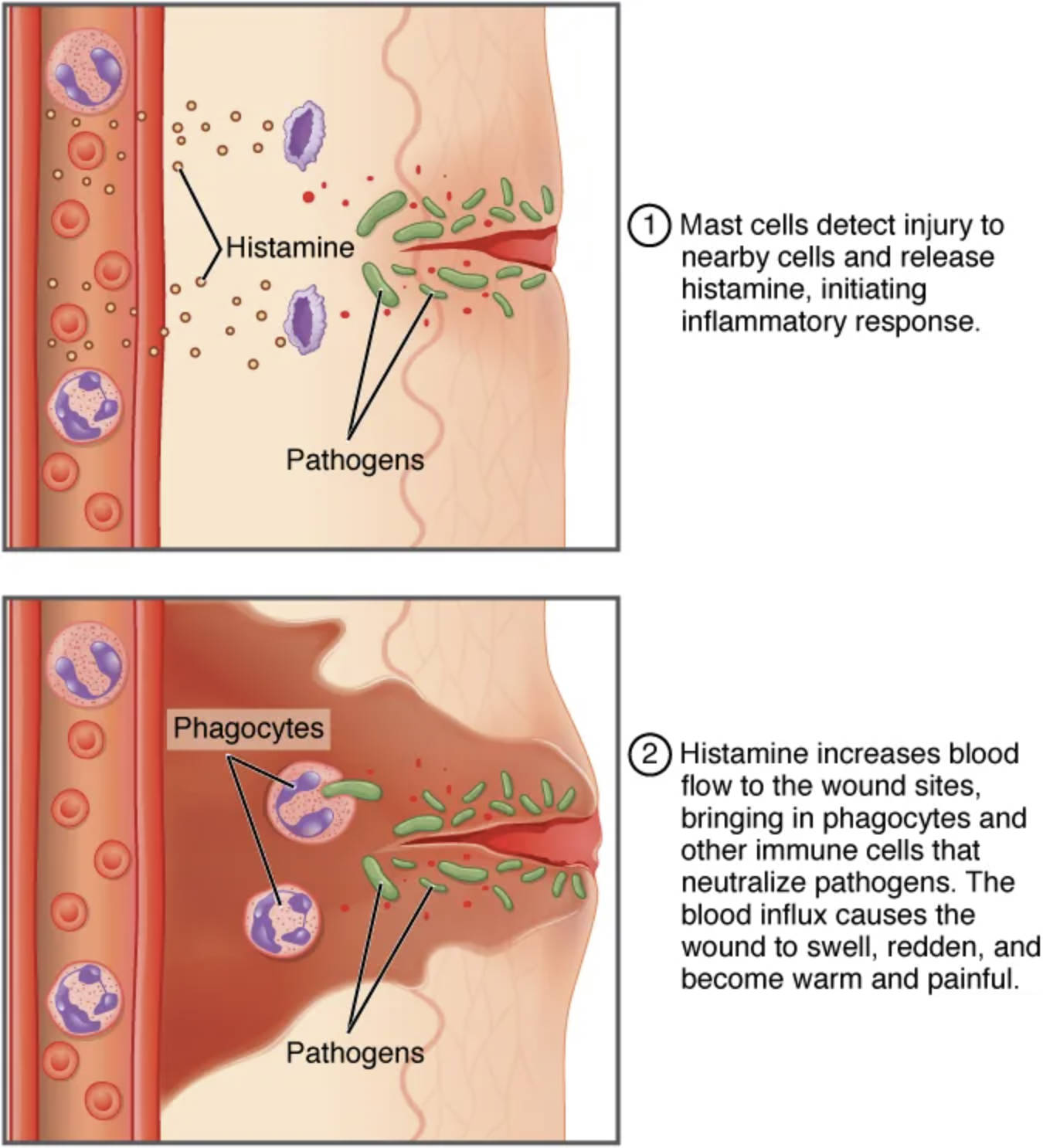 Decoding the Inflammatory Response in the Human Body
