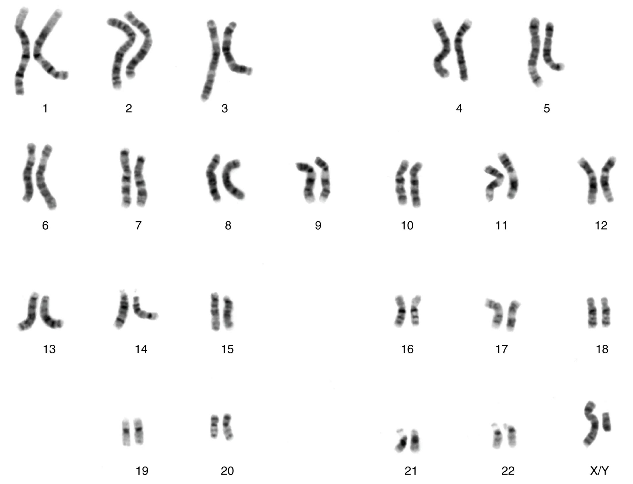Male Karyotype: Chromosomal Structure and Genetic Organization