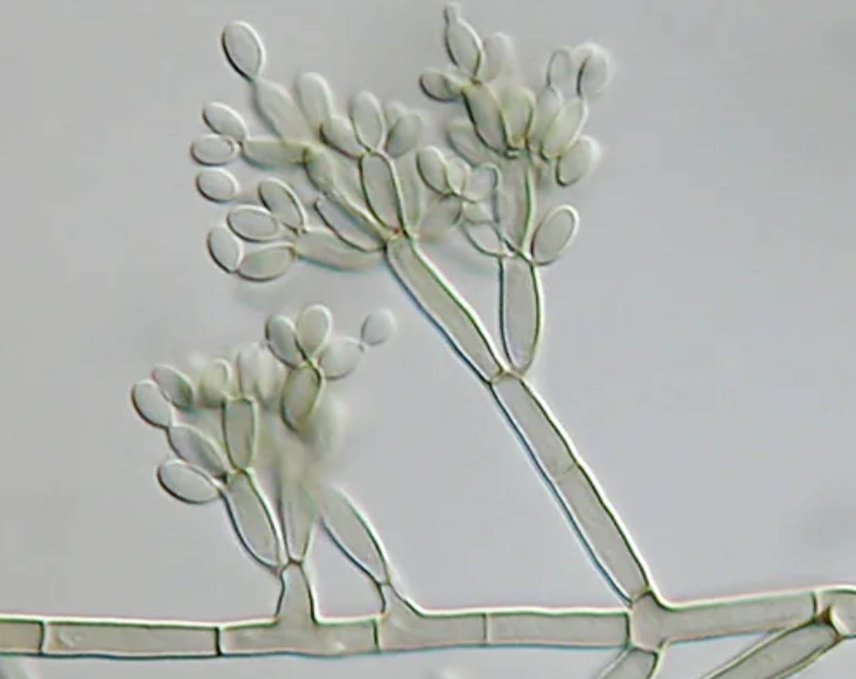 Microscopic Analysis of Fonsecaea pedrosoi: The Agent of Chromoblastomycosis