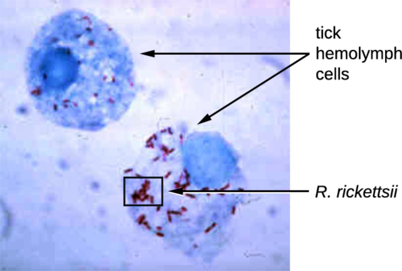 Rickettsia rickettsii: Pathophysiology and Rocky Mountain Spotted Fever