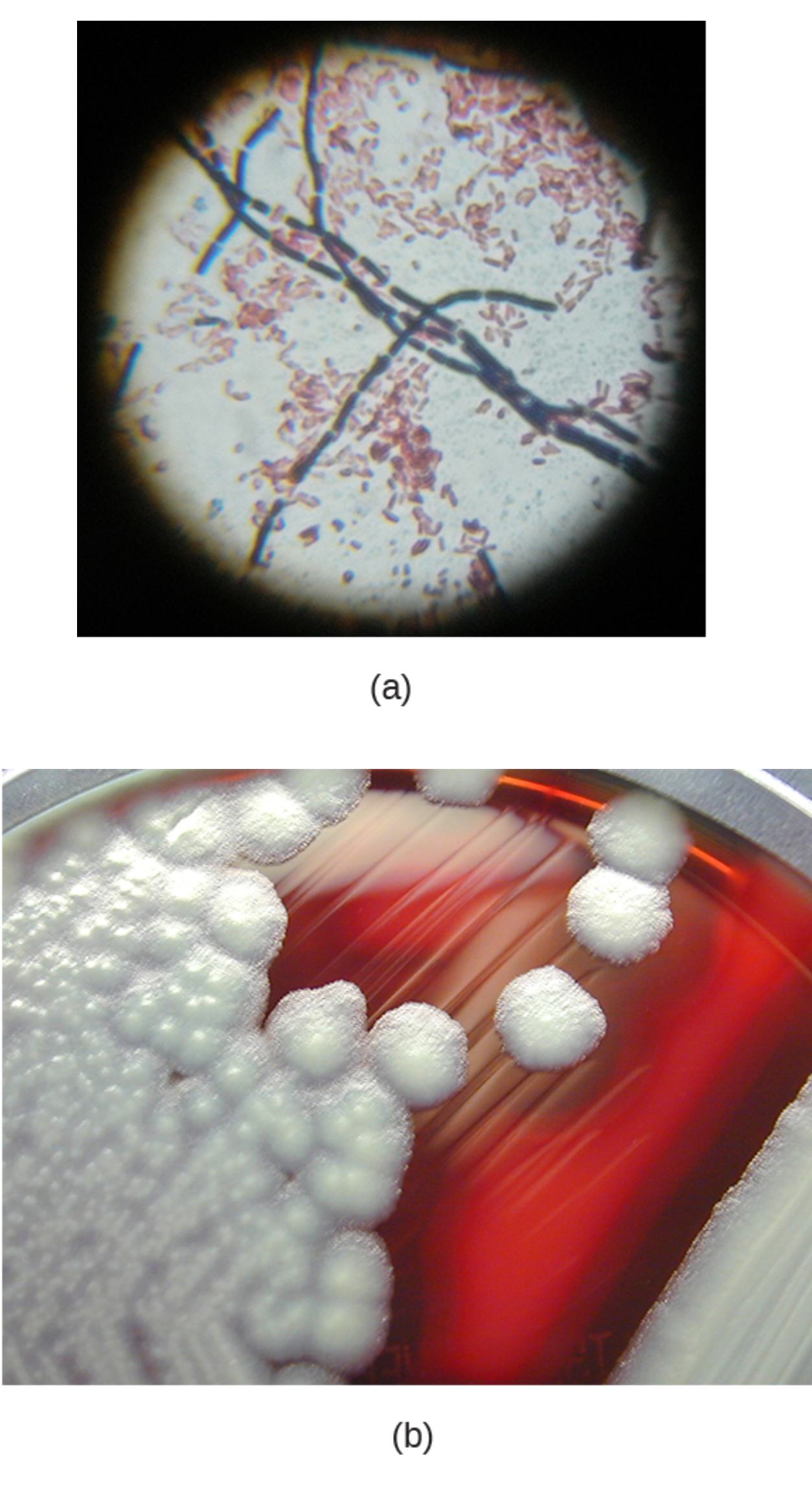 Bacillus cereus: Gram Stain and Blood Agar Colony Morphology