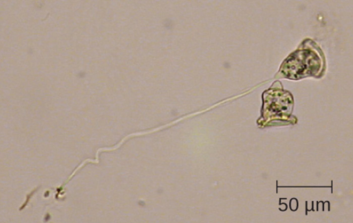 Understanding Eukaryotic Cell Morphology: An In-Depth Look at the Bell-Shaped Vorticella
