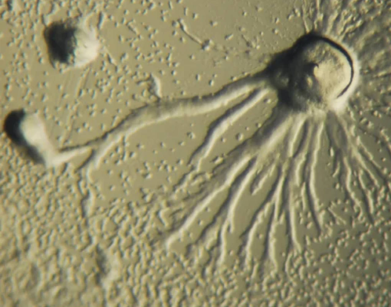 Dictyostelium discoideum: Model Organism in Medical Research