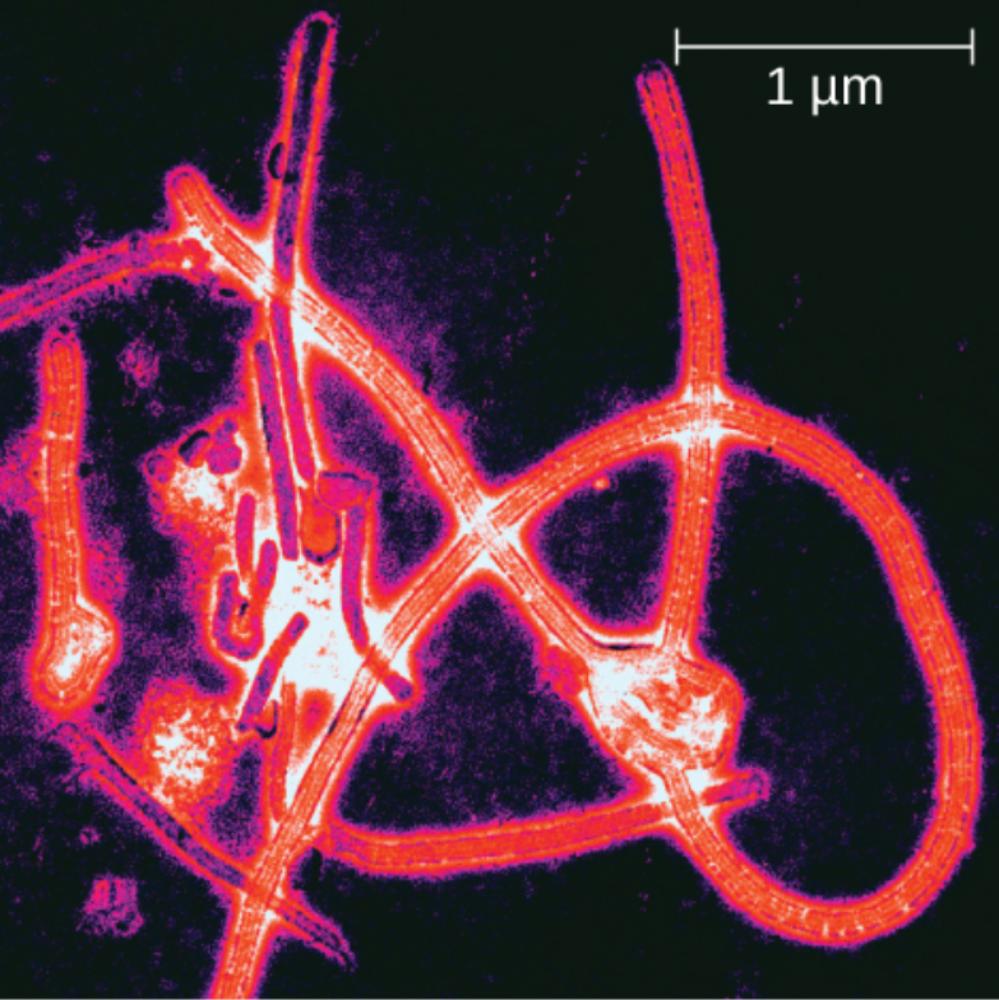 Ebolavirus Morphology and Pathogenesis: A Microscopic Analysis of the Filovirus Family