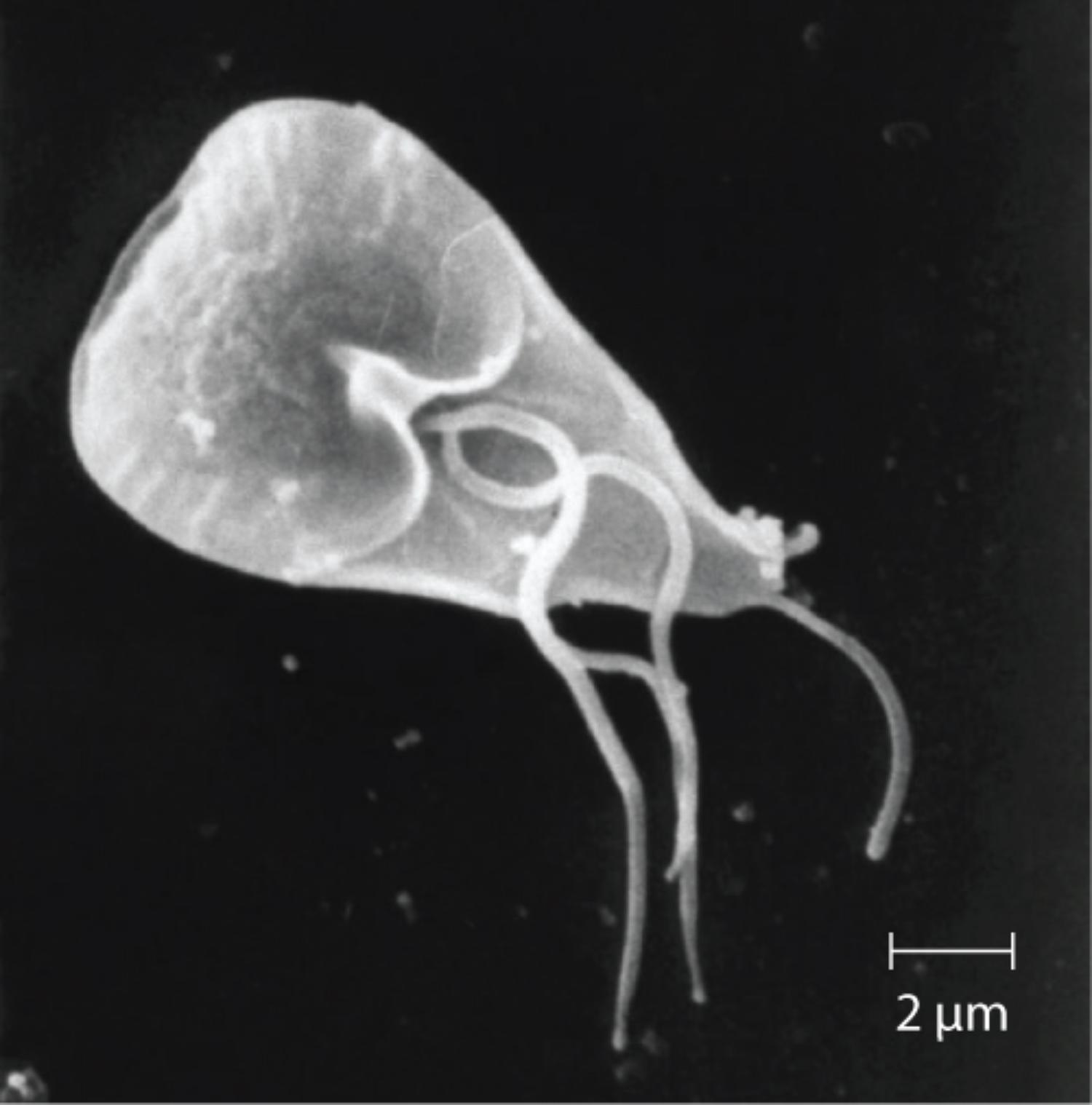 Giardia Lamblia: Morphology, Pathogenesis, and Clinical Implications