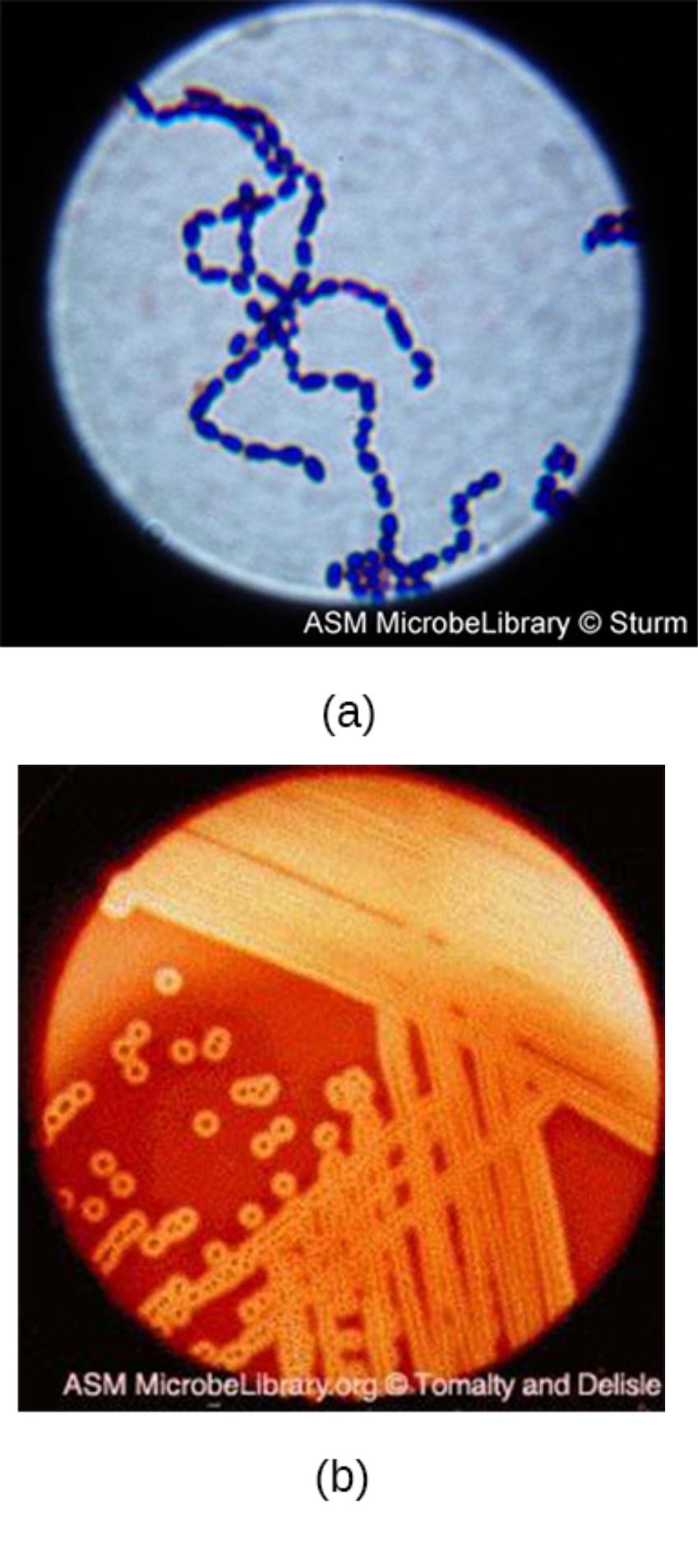 Streptococcus pyogenes: Morphology, Pathogenesis, and Clinical Diagnostic Markers