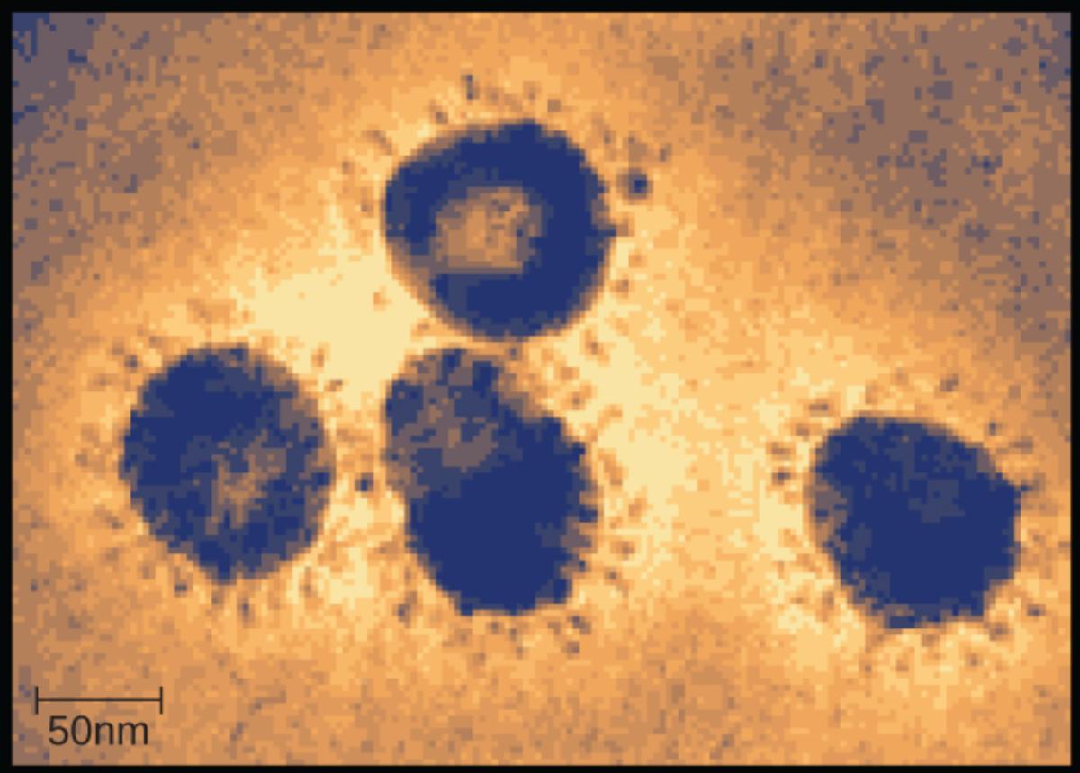Microscopic View of the Coronavirus Family: Morphology and Clinical Impact