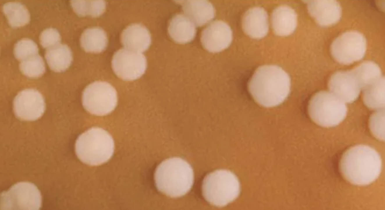 Neisseria meningitidis on Chocolate Agar: Clinical Overview of Meningococcal Disease