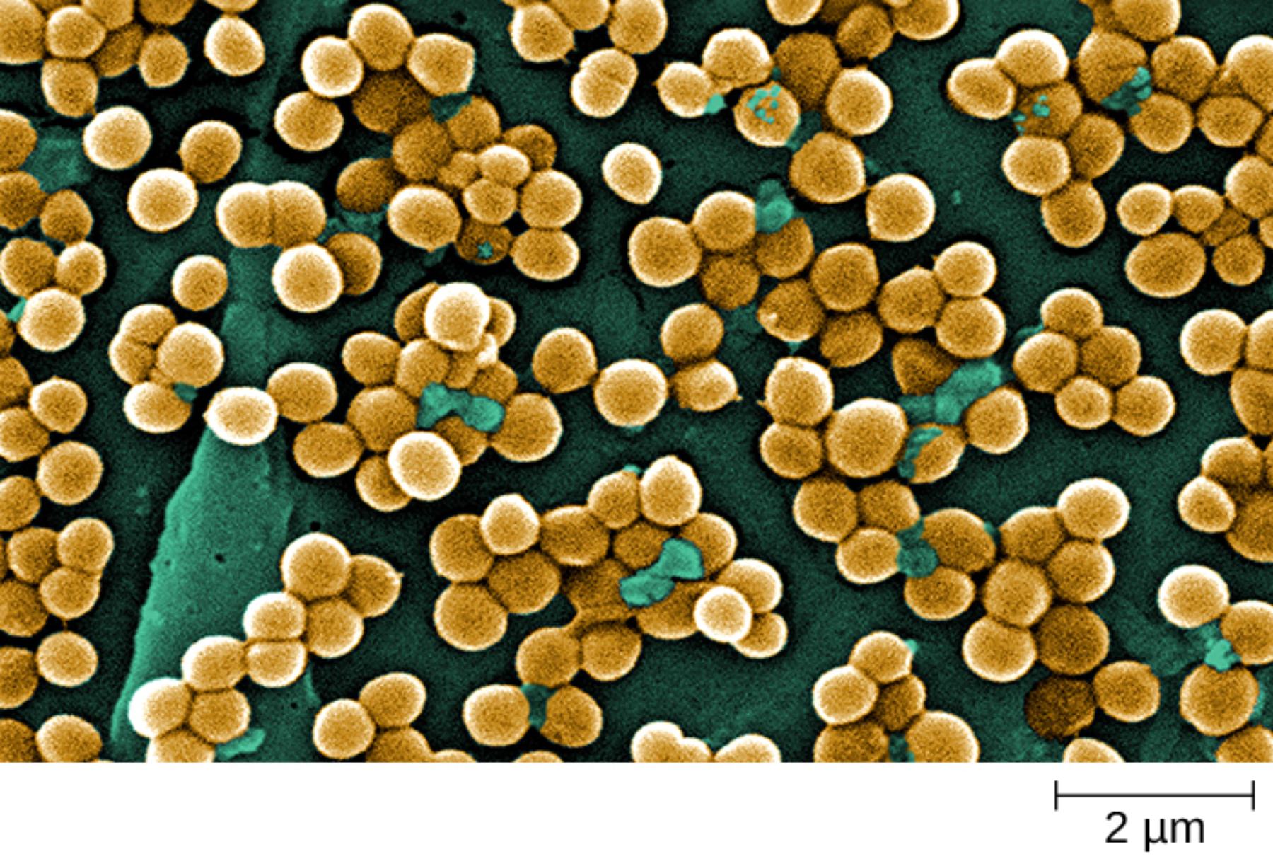 SEM of Staphylococcus aureus: Grape-Like Clusters and Surface Features