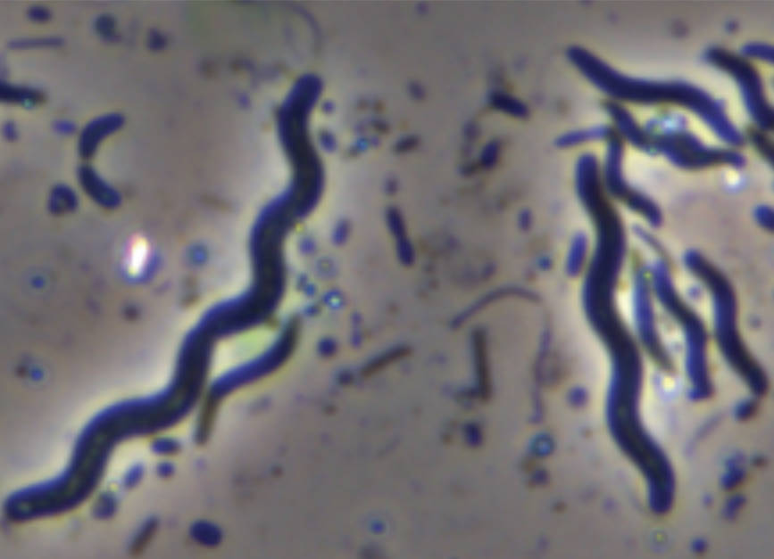 Spirillum Morphology: Anatomy and Biological Characteristics of Spiral Bacteria