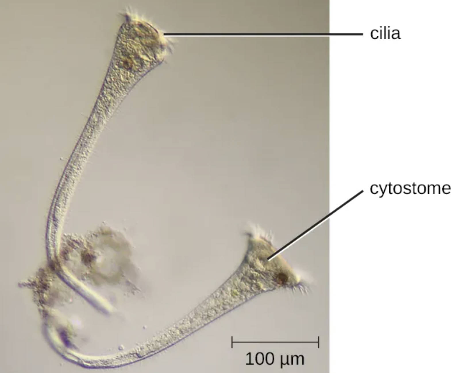 Stentor roeselii: Microscopic View of a Giant Trumpet-Shaped Ciliate