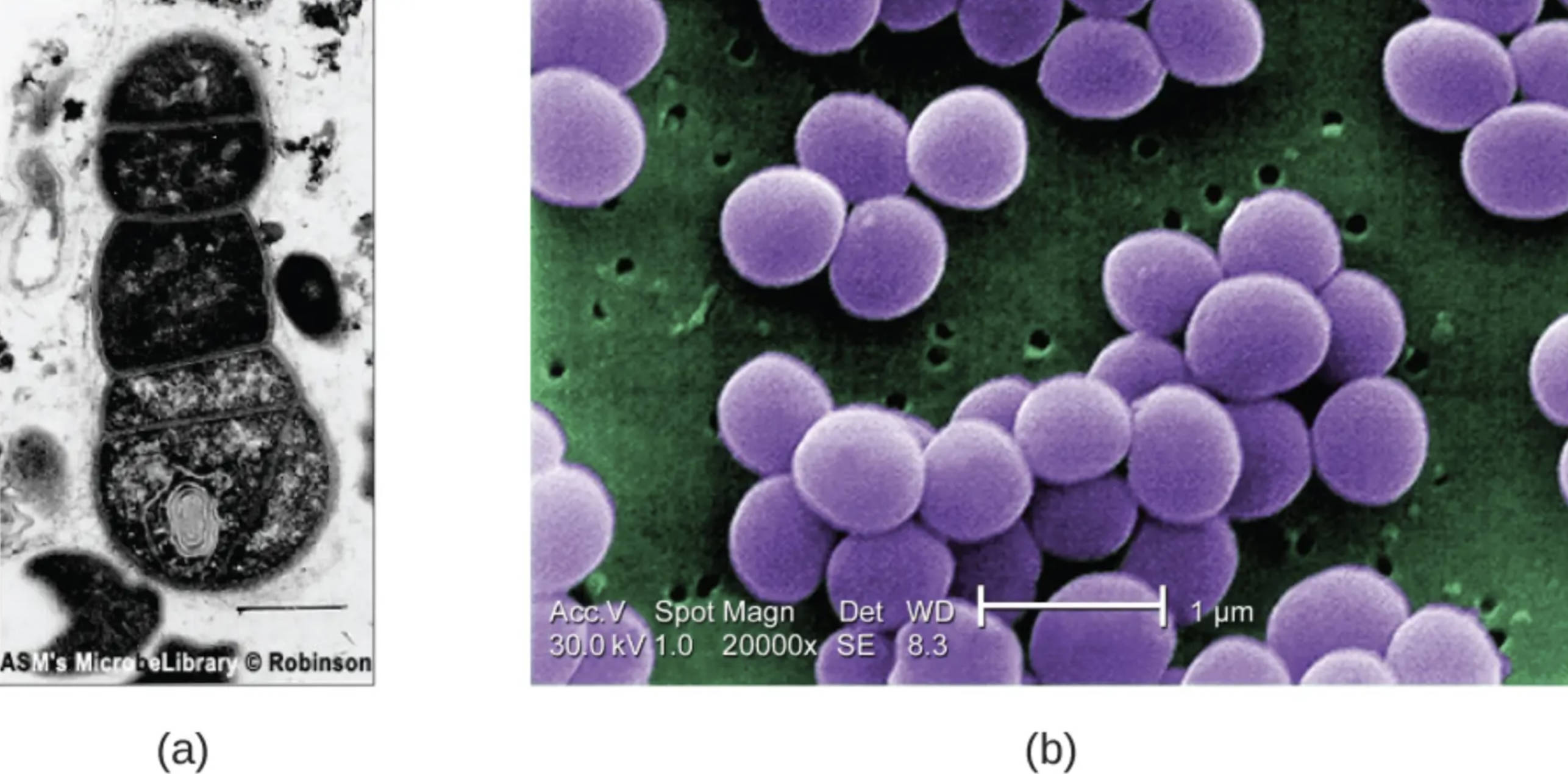 Visualizing the Microscopic World: TEM and SEM Imaging of Staphylococcus aureus and Biofilms
