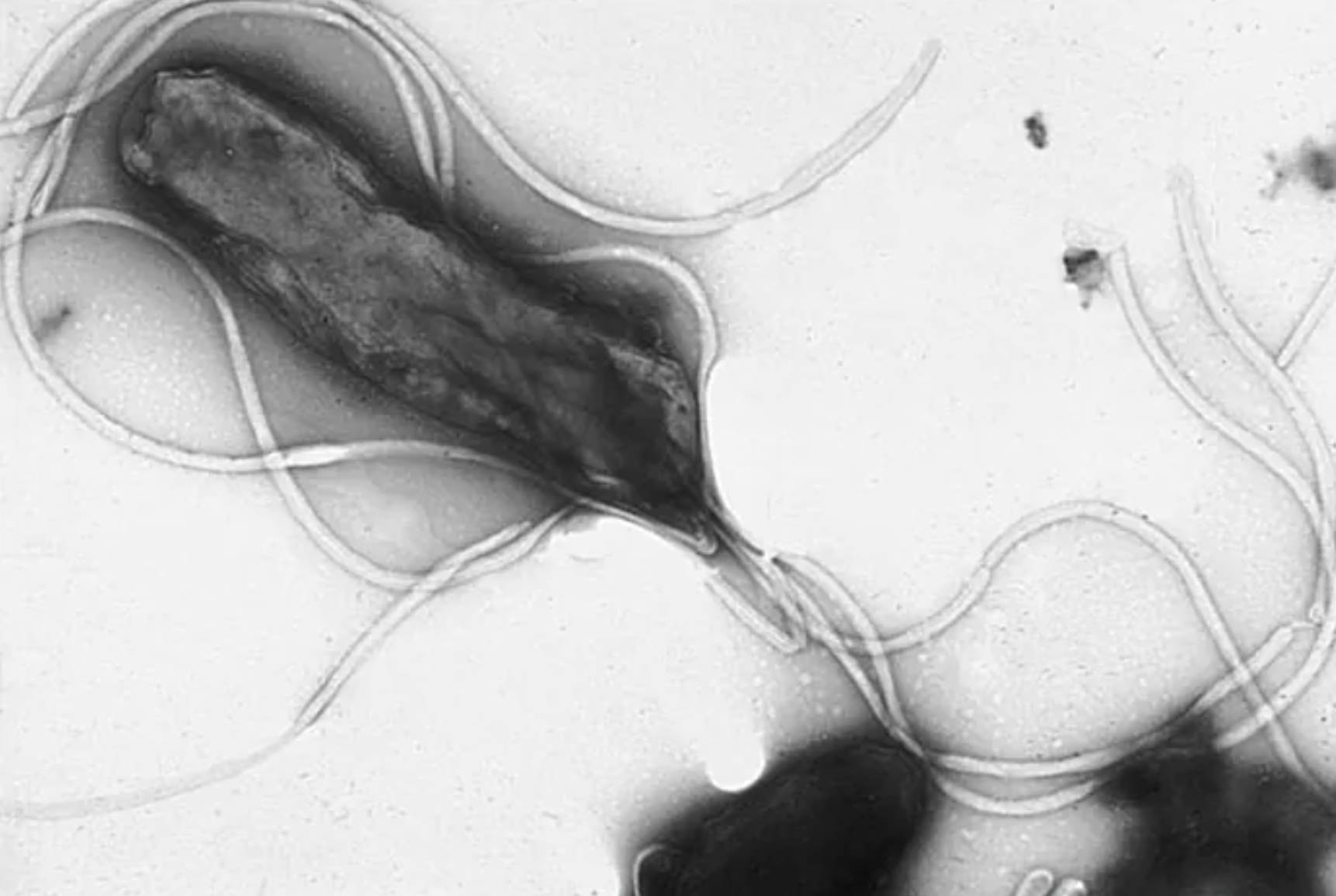 Helicobacter pylori: The Bacterial Origin of Chronic Gastritis, Ulcers, and Stomach Cancer