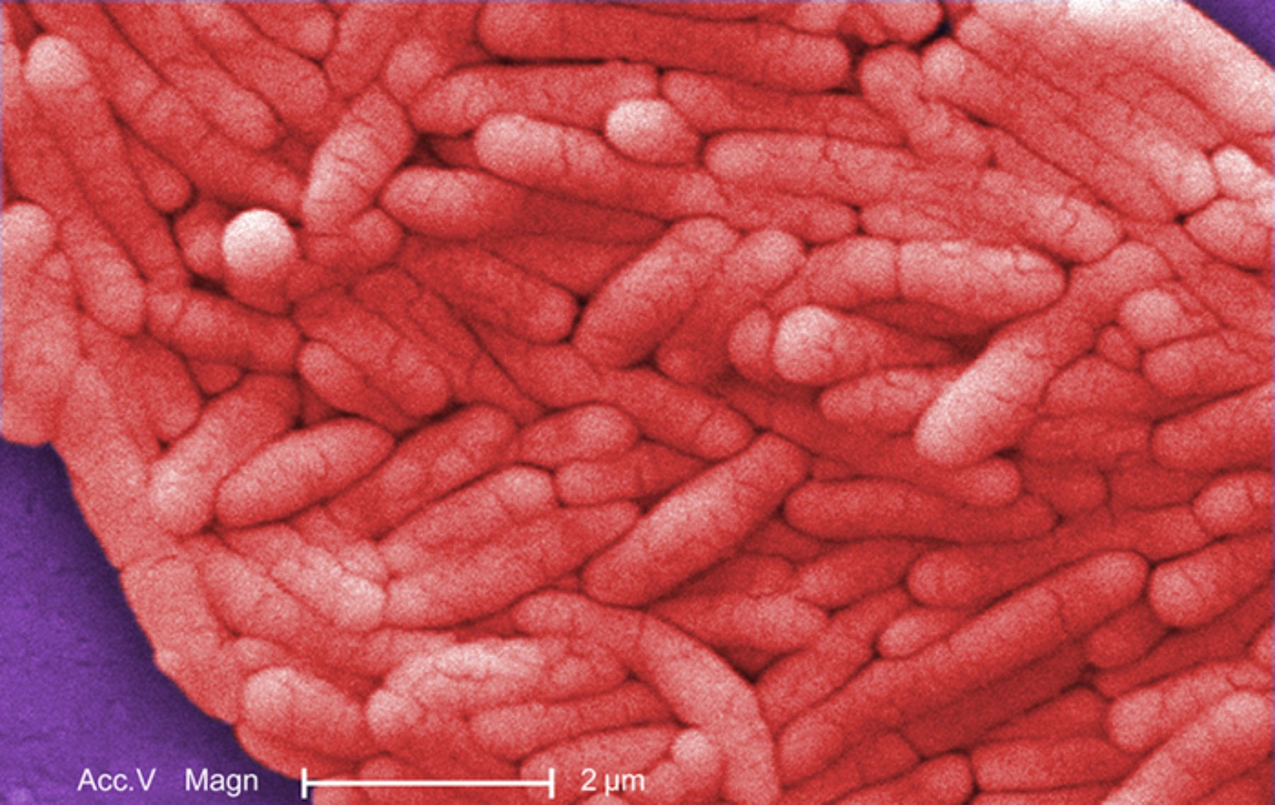 Salmonella typhi: Morphology, Pathogenesis, and the Clinical Impact of Typhoid Fever