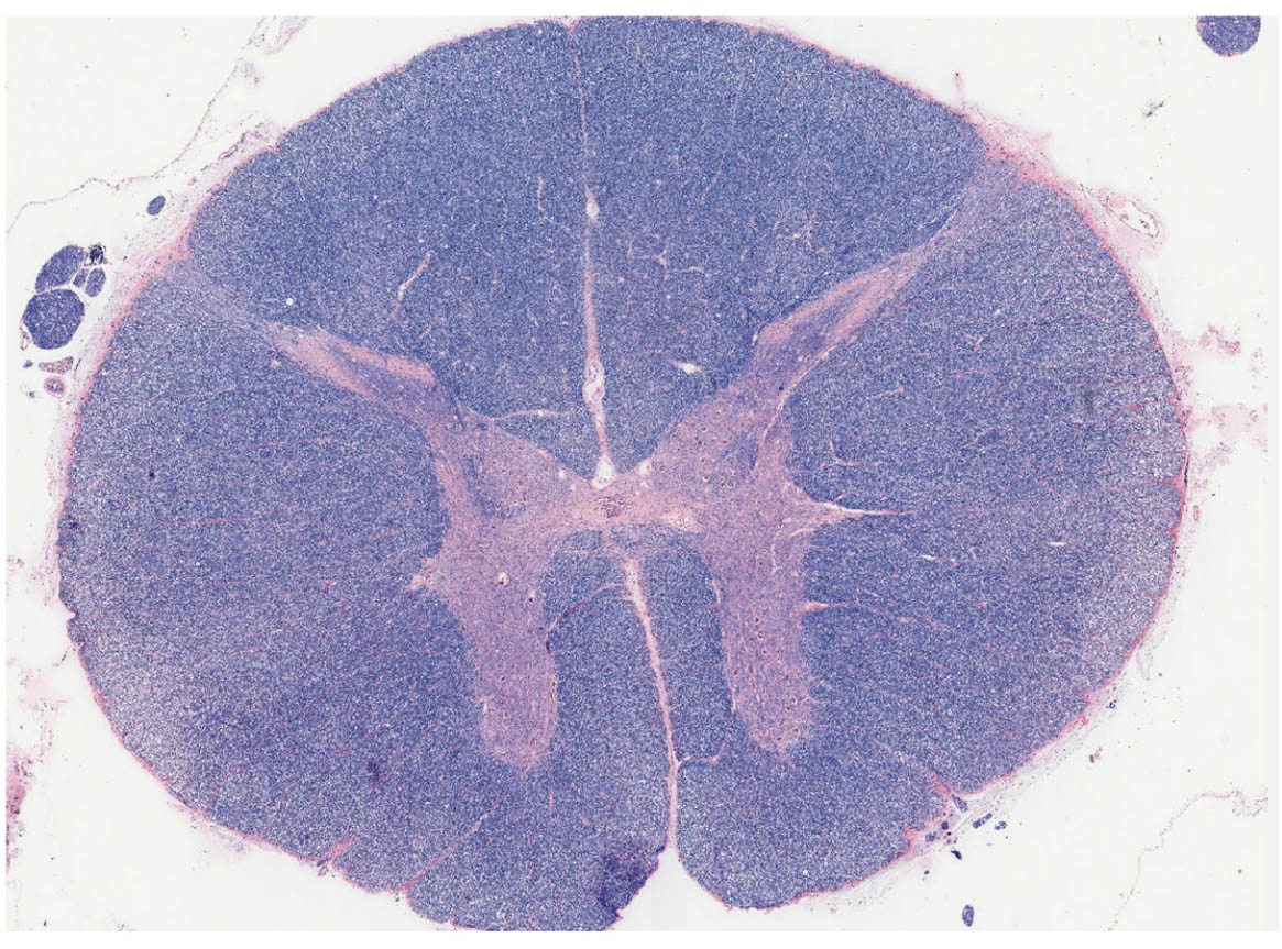 Cross-Section of the Spinal Cord: Microscopic View