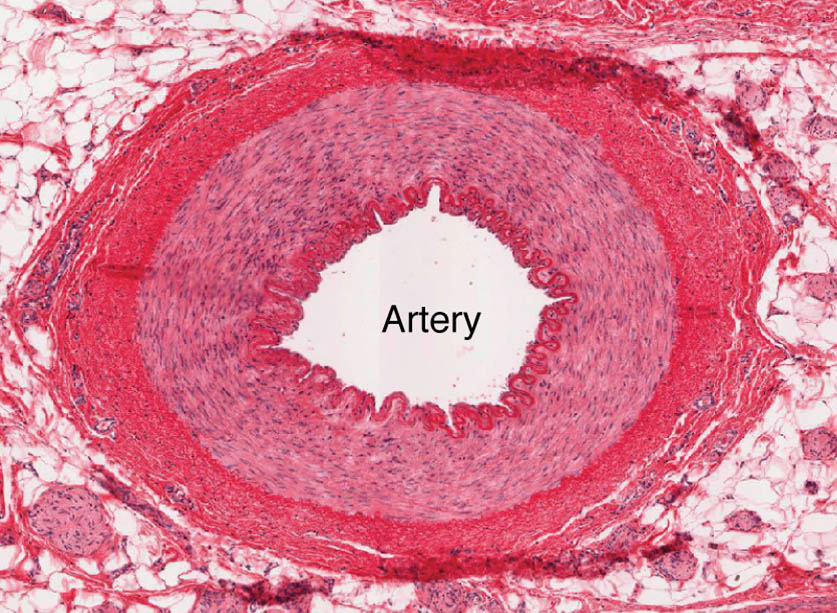 Arterial Anatomy: Microscopic Insights into Blood Vessel Structure