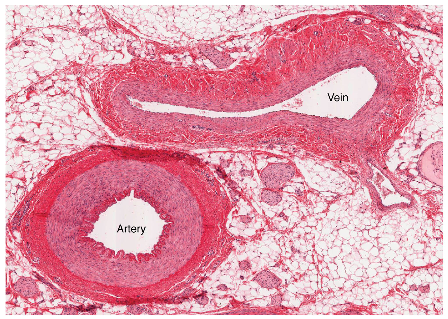 Blood Vessel Anatomy: Insights from Microscopic Views