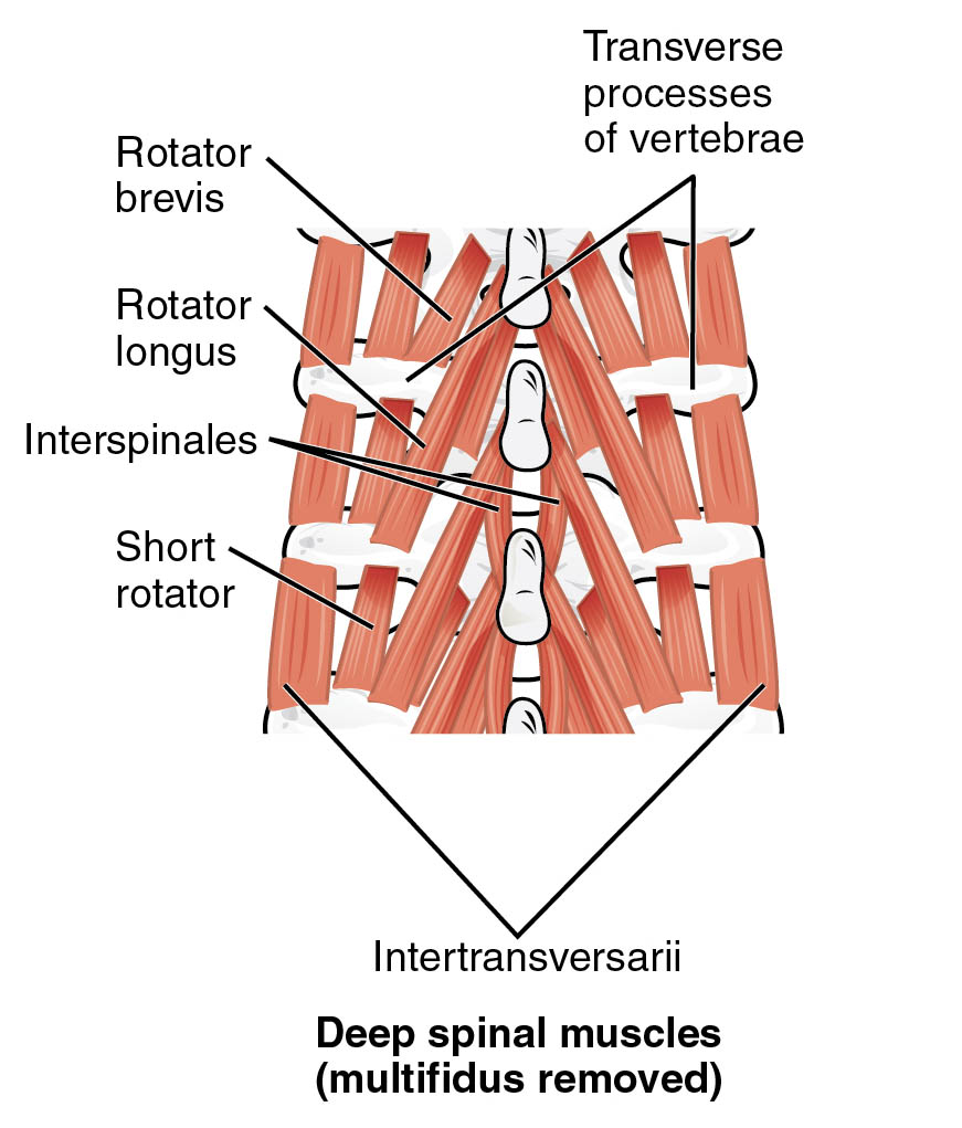 Understanding Deep Spinal Muscles: Anatomical Structure with Multifidus Removed