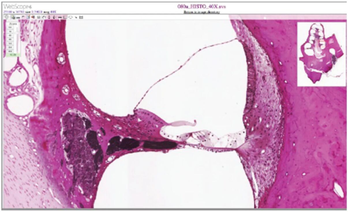 Cochlea and Organ of Corti Under Microscopic View: A Deep Dive
