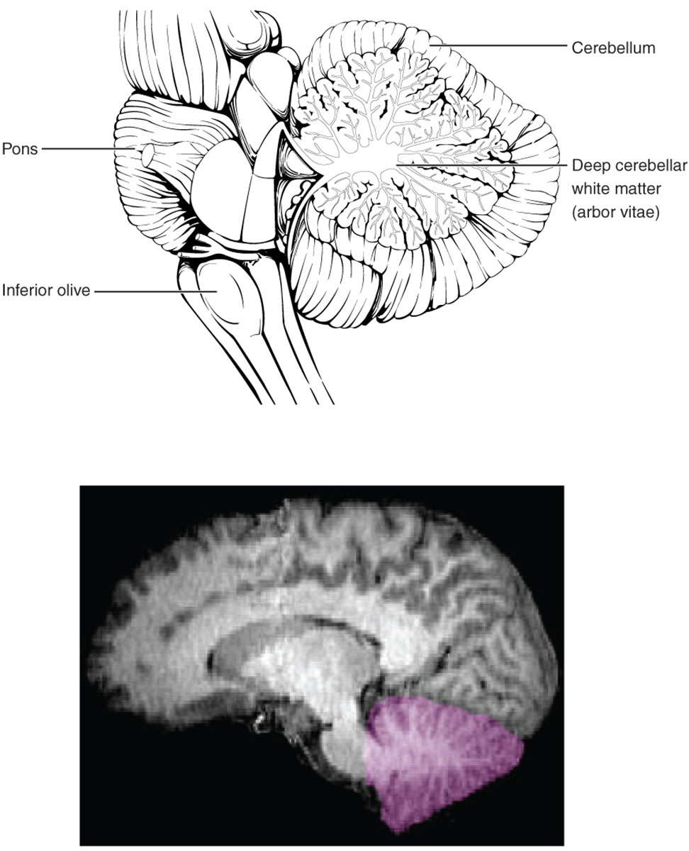 The Cerebellum: Anatomical Structure and Imaging Insights