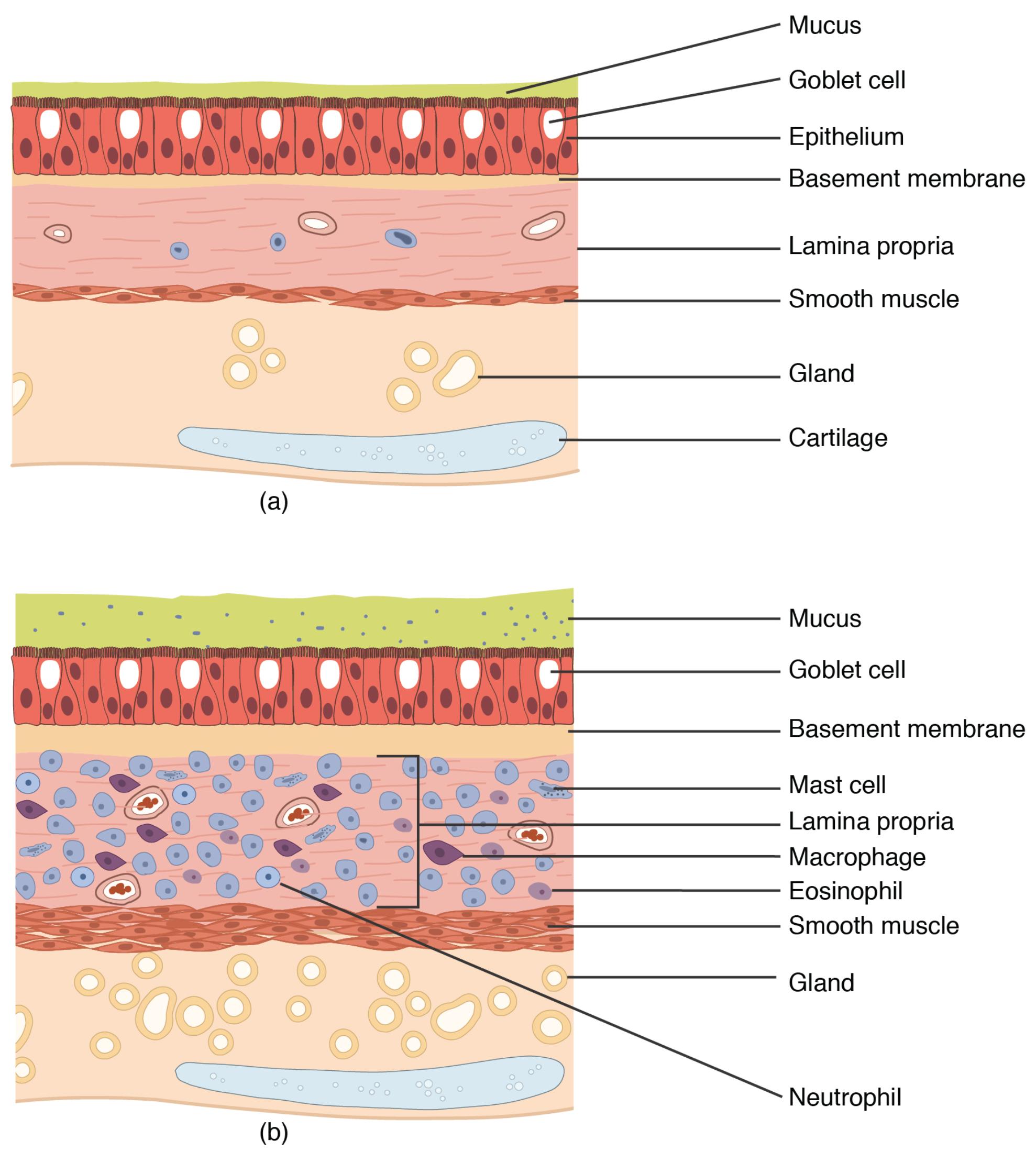 Understanding Normal Lung Tissue vs. Bronchial Asthma: A Comparative Study