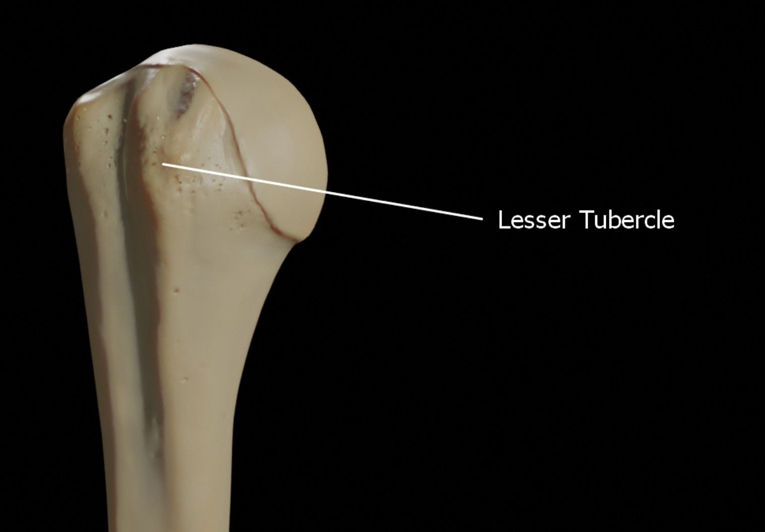 Lesser Tubercle of the Right Humerus: Anatomy and Clinical Significance