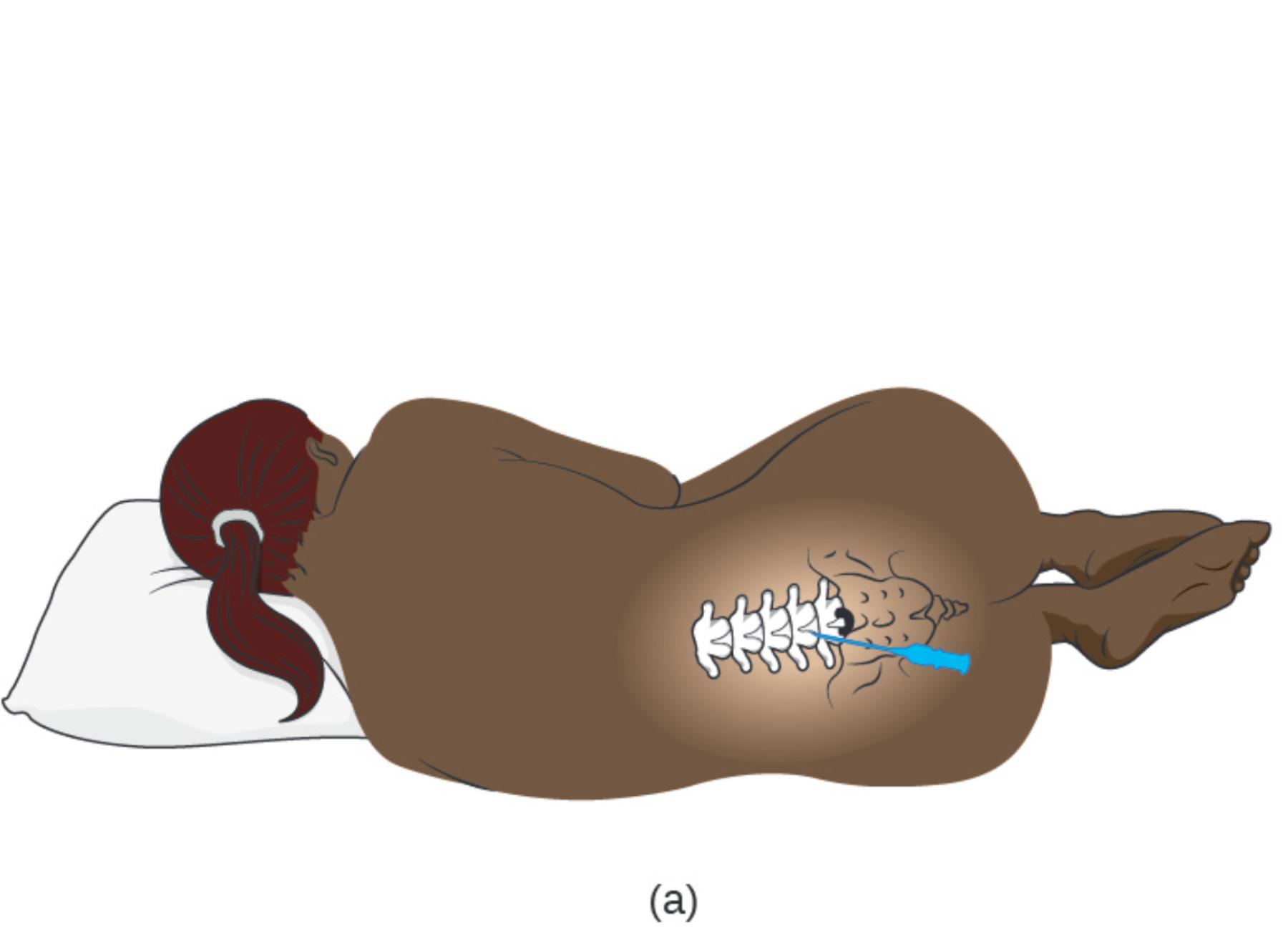 Understanding the Adult Lumbar Puncture: Anatomy and Positioning for CSF Collection
